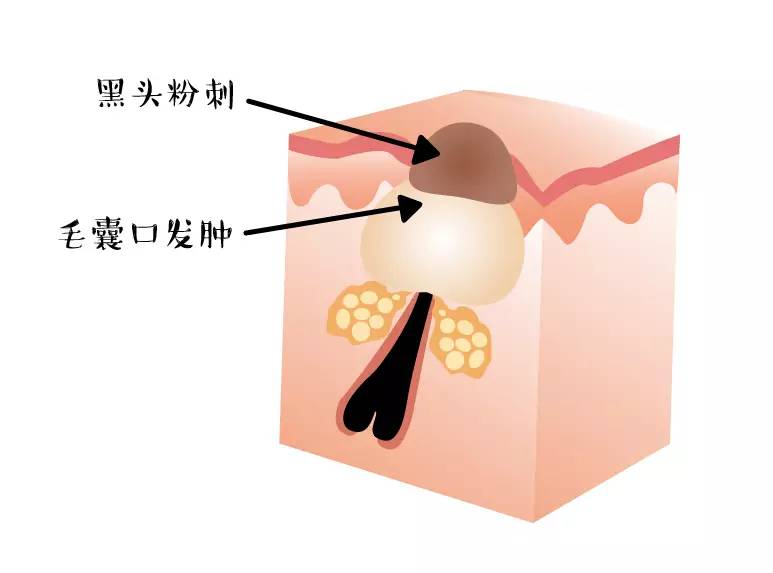 平价清洁面膜泥哪个牌子好,清洁面膜真实评测推荐