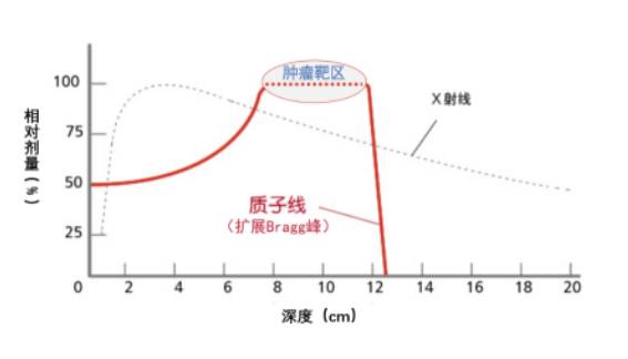 旋转束质子肿瘤放射治疗系统,Probeam360°质子放射治疗系统费用