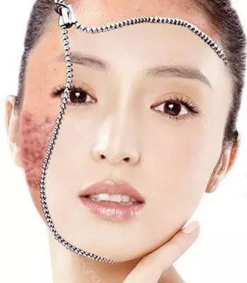 乌鲁木齐祛痘痘最好的地方,乌鲁木齐专业消除痘痘