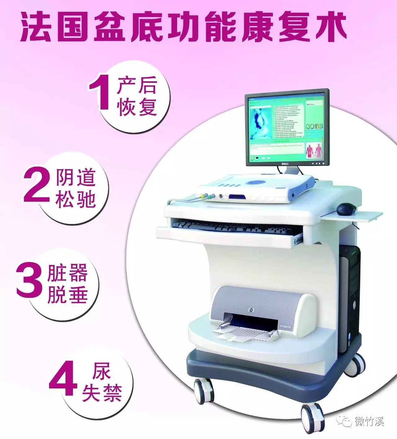 微新闻直播,法国盆底修复仪器