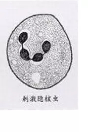 传染疾病的防治措施,白点病会传染给人吗