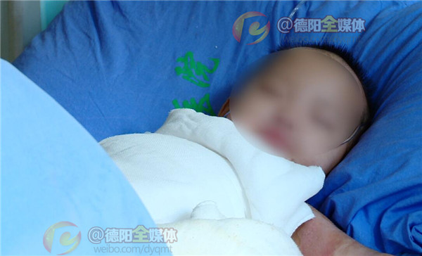 19岁烧伤女孩小玲出院啦,烧伤女孩小玲最新消息