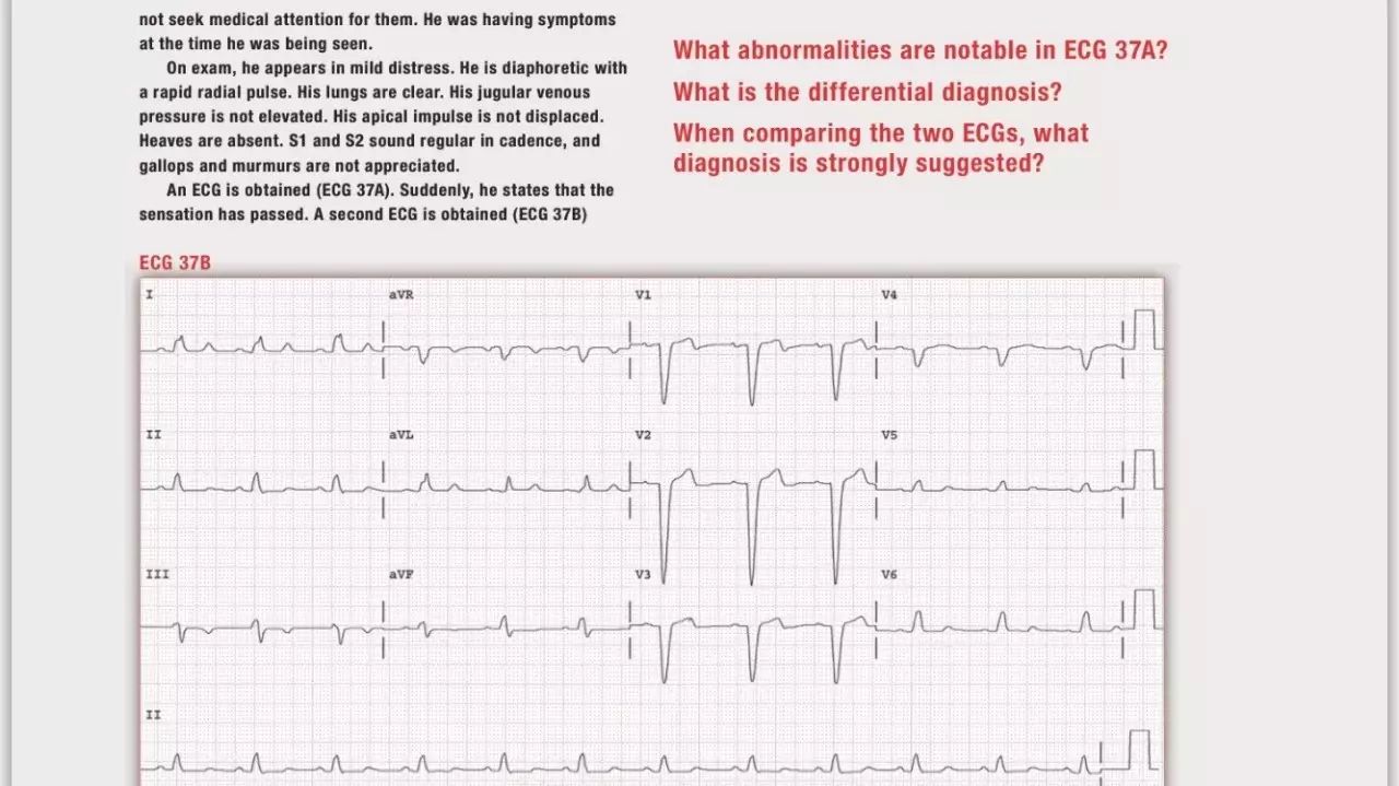 读心有术100期,读心有术171