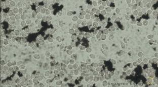 纹身油墨对人体的危害,纹身墨水涂在身上有什么危害