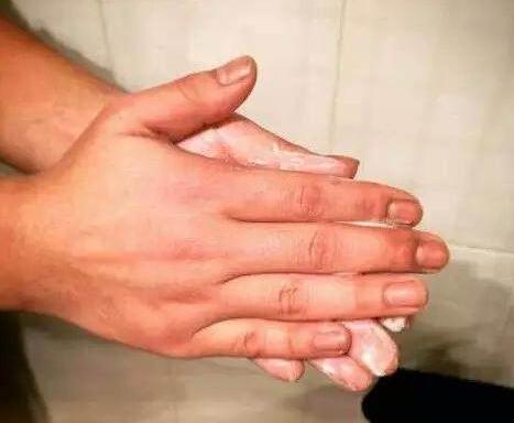 脏辫能每天洗头吗,洗脏辫的时候脏辫会散吗