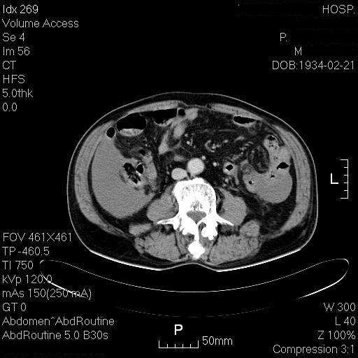 为什么腹痛会引起面色苍白,腹痛未明确原因可以输液吗