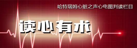 读心有术150期,读心术169