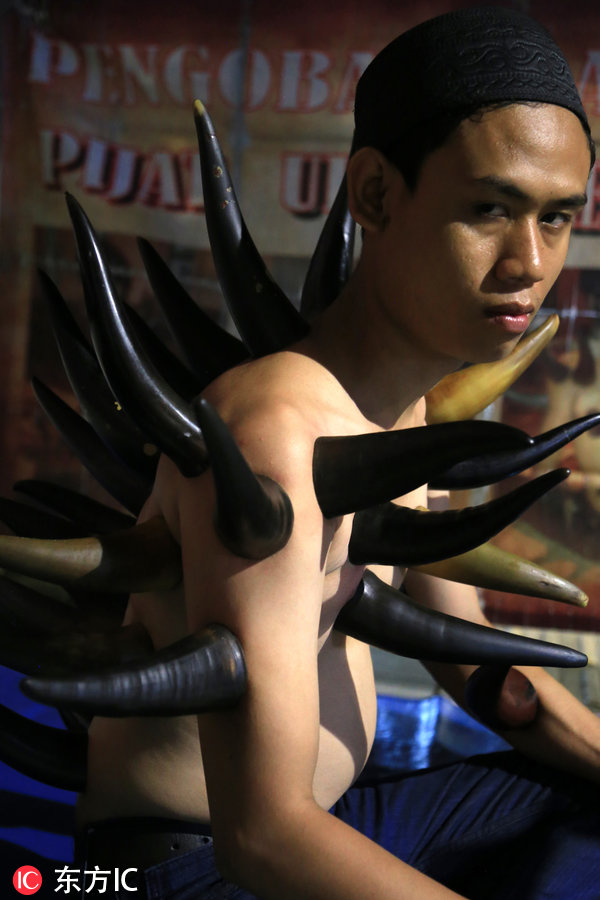 印尼治腰腿疼的药,大连牛角拔火罐疗法