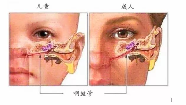 三岁宝宝半夜三更突然哭闹,三更半夜小孩的耳朵疼是怎么回事