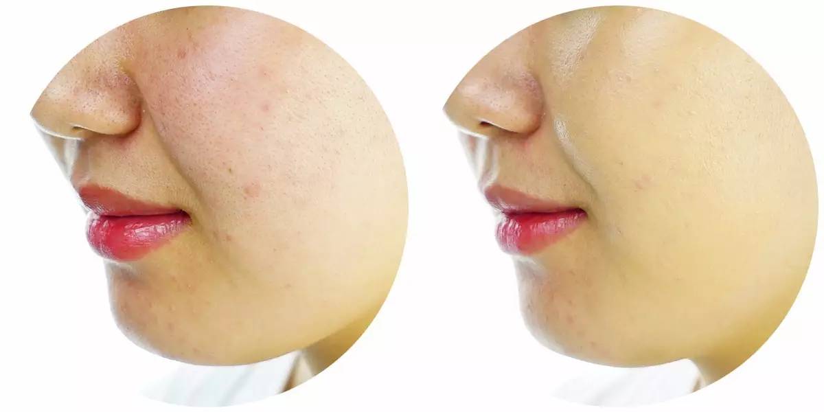 大牌粉底和平价粉底有什么区别,平价粉底和大牌粉底差距在哪里