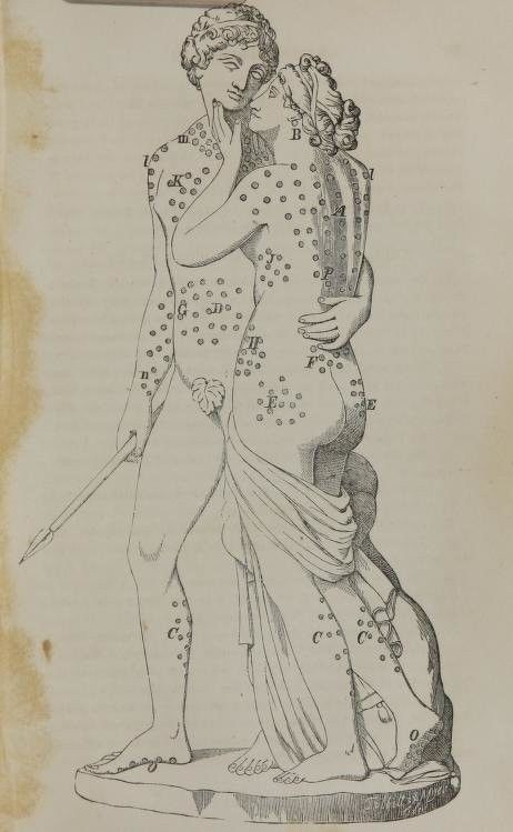 19世纪的针刺万能疗法是这样的