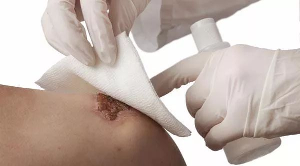 身上伤口不易愈合是怎么回事,身体后面有伤口一直不愈合