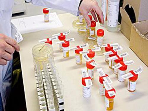 怀孕尿检什么指标,尿检指标科学解读