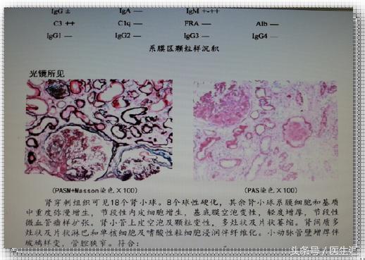 糖尿病肾病肾小管受损怎么治,慢性肾衰竭与糖尿病肾病鉴别诊断