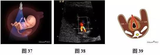 孕26周进行胎儿超声心动图检查,孕11-14周胎儿超声检测报告