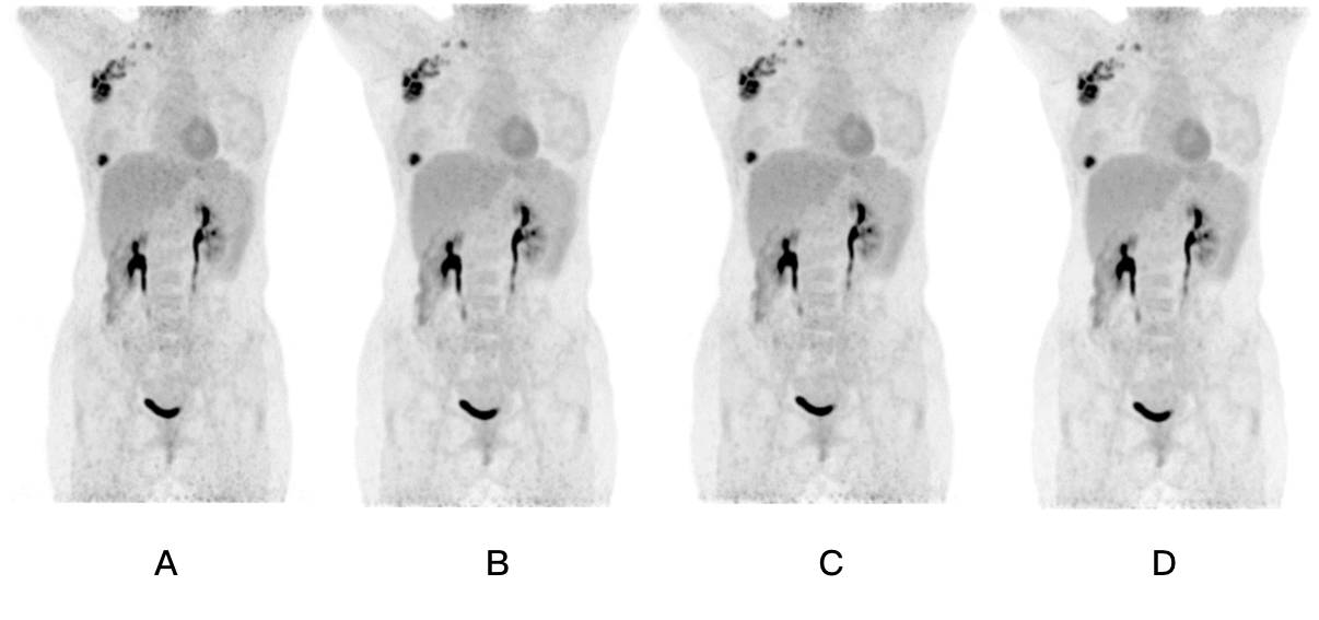 众大咖赴丹佛“掘金”,世界级宝藏“CreatedinChina”?!