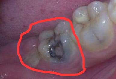 鐗欓緢鑲跨棝鎬庝箞杩涢,鐗欓緢鑲跨棝鎬庝箞杩涜娌荤枟