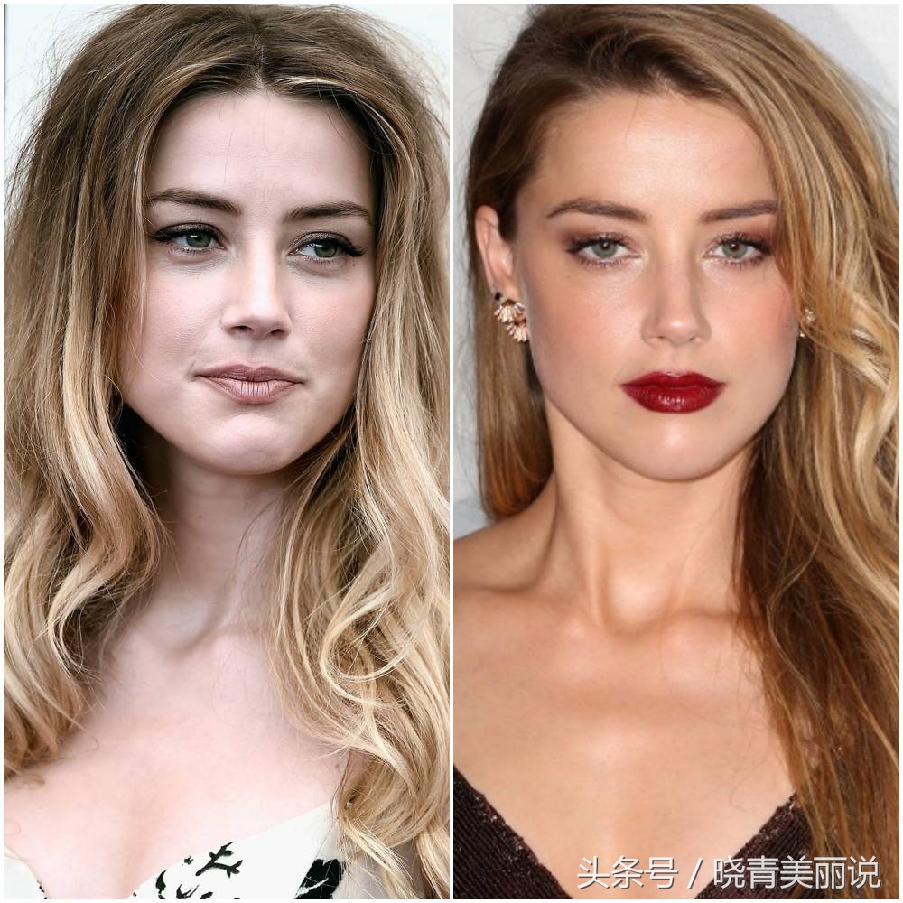 打完苹果肌脸僵了,打完苹果肌肿一块硬硬的