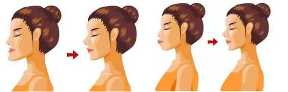 牙齿矫正钢牙套多少钱,淄博牙齿矫正多少钱