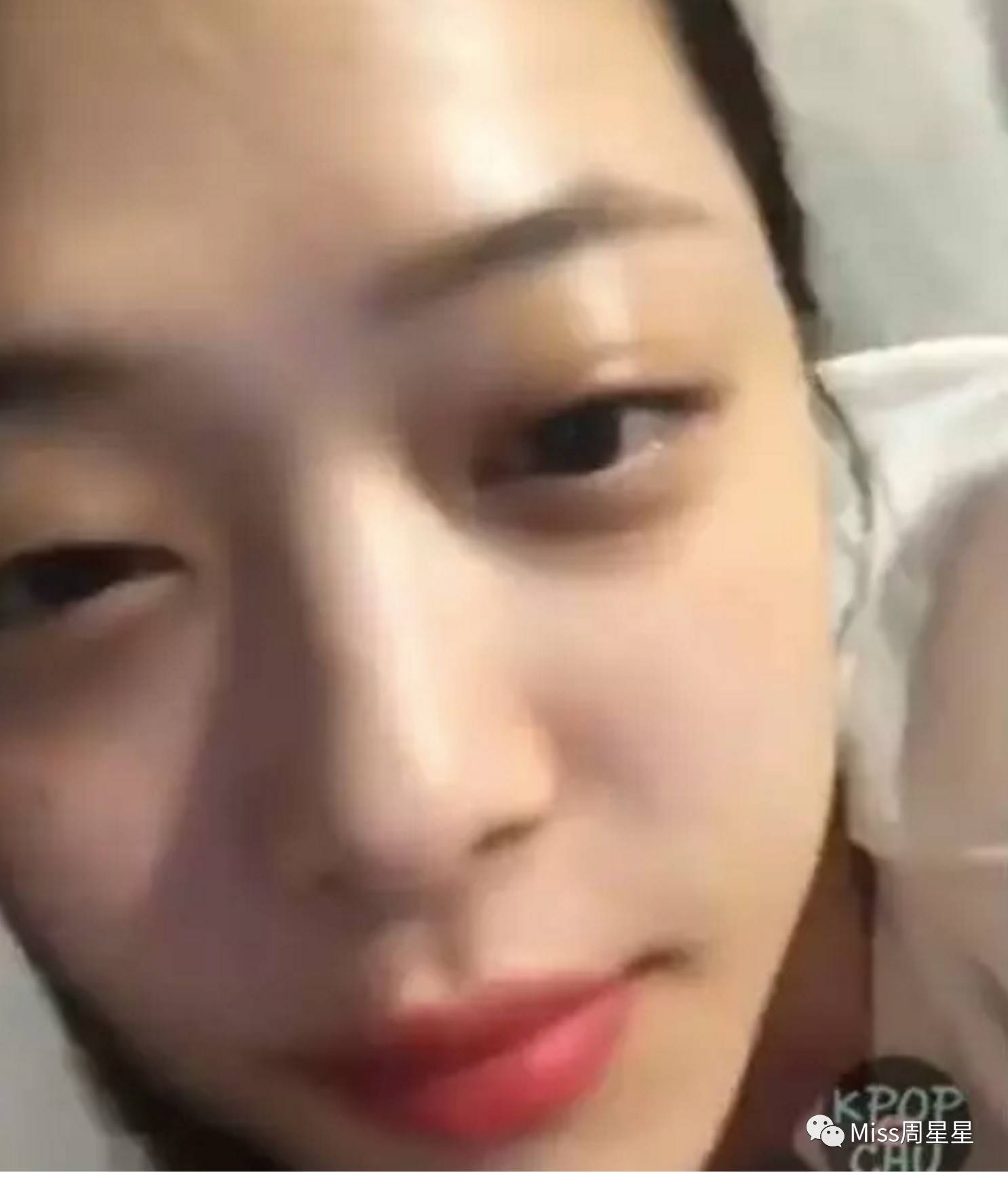 千年黑眼圈解决方案,万年黑眼圈有救的吗