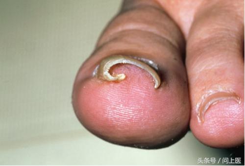 脚的10大症状图片,脚最容易得这8种病