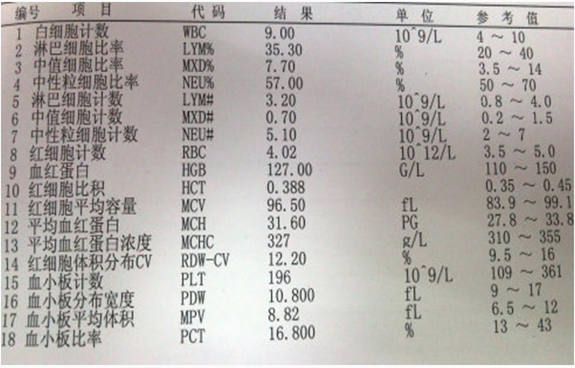 血常规报告单数据可以看出贫血,地中海贫血的血常规报告单怎么看