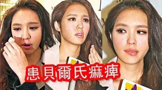 安吉丽娜朱莉面瘫,安吉丽娜朱莉有多有名