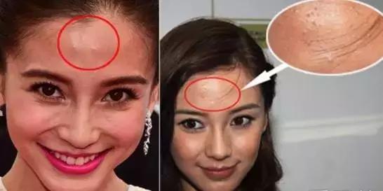 治痘痘烂脸的产品,祛痘印闭口效果最好的产品测评