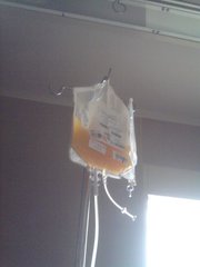 乏力、双下肢不痛痒的“出血点”，竟是“累出来”的“血液病”？