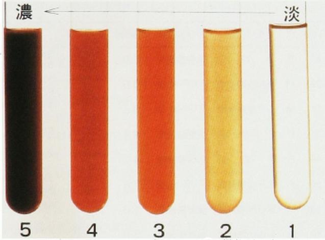 肾出现问题尿液有什么变化,肾病患者尿液增多怎么回事