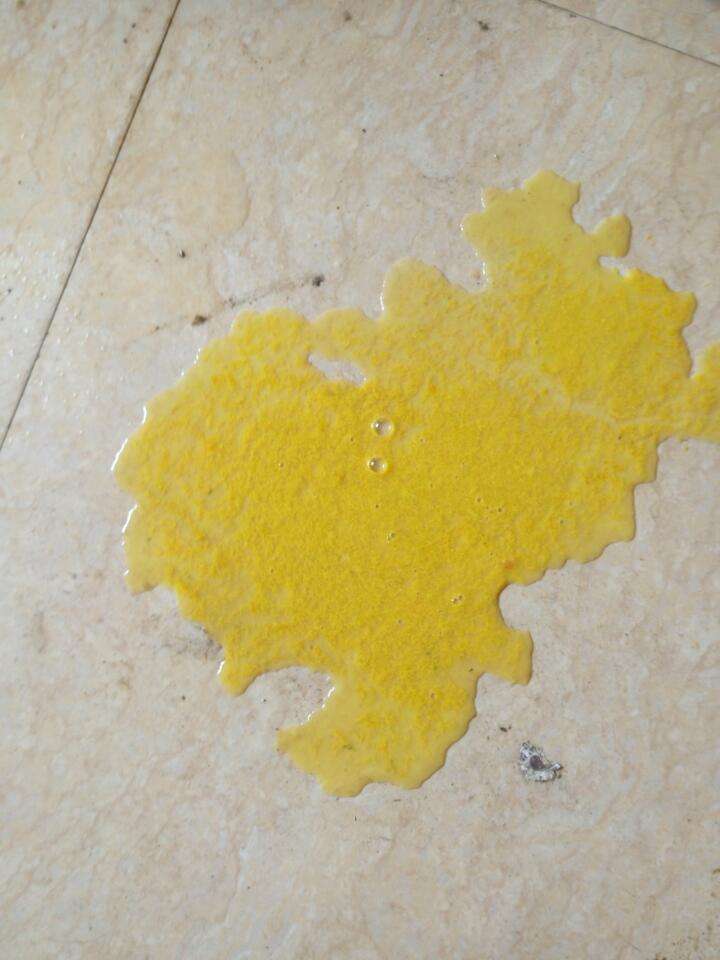 2岁宝宝拉肚子不小便怎么办,2岁宝宝一直肚子不舒服还拉肚子