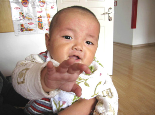 幼儿急疹出现的高热惊厥,幼儿高烧39度惊厥