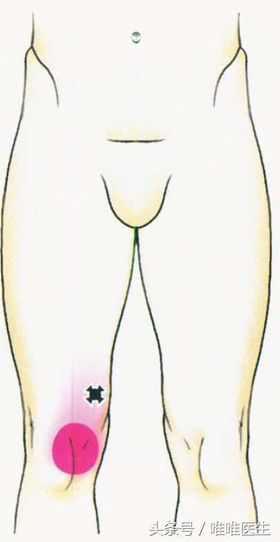 膝盖疼痛治疗经验分享,膝关节总结