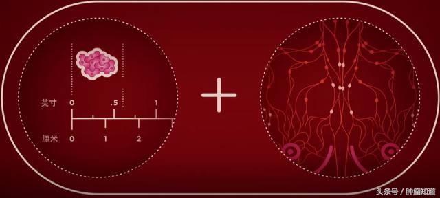 3阴性乳腺癌2期能治好吗,乳腺癌3期a是什么意思