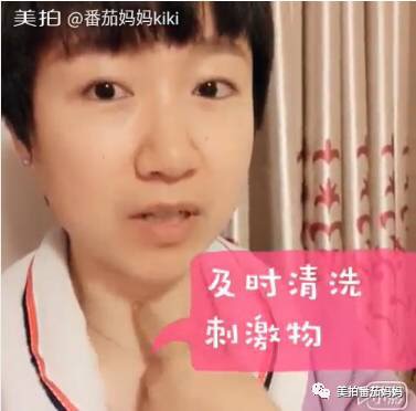 婴儿淹脖子发红怎么处理,宝宝淹脖子和红屁屁用什么产品