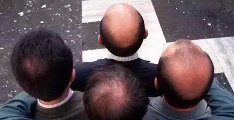 轻微脱发毛囊没有闭合可以生发吗,毛囊脱发很严重怎么治疗最有效