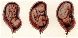 李时珍惊人药方,李时珍尝遍各种草药险些中毒