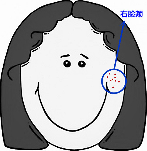 超级齐全的痘痘护理，有痘痘的妹子抓紧收藏