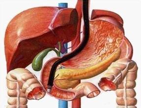 癌王之王胰腺癌能活多久,癌中之王胰腺癌