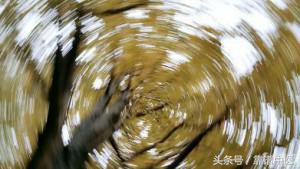 突然眩晕天旋地转恶心吐中医,痰湿中阻头晕呕吐中医方剂