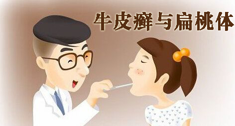 牛皮癣与hpv有关系吗,牛皮癣与血沉有关吗