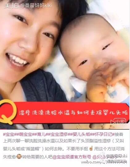 婴儿湿疹头垢洗了之后一直在出水,新生儿头垢和湿疹结痂的区别