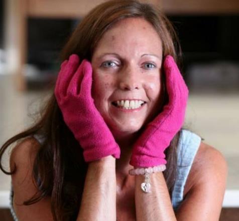 为何脸上皱纹是竖的,脸上皱纹一抹就消失是真的吗