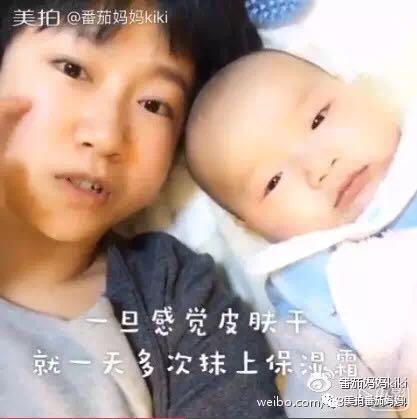 婴儿湿疹头垢洗了之后一直在出水,新生儿头垢和湿疹结痂的区别