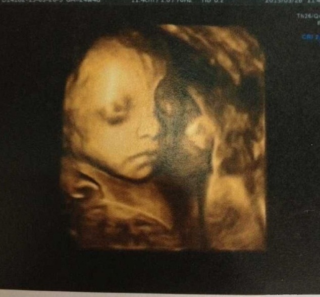 39周顺产的胎宝宝,孕39周想顺产的妈咪注意事项