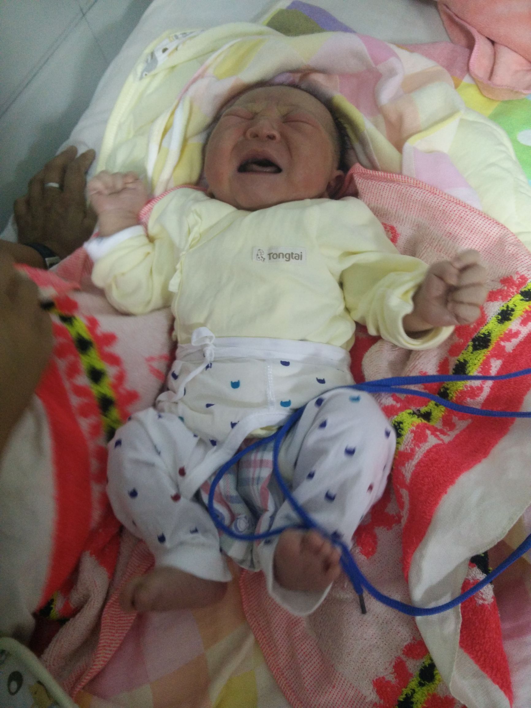 宝宝湿疹妈妈很着急,宝宝湿疹的正确防治方法