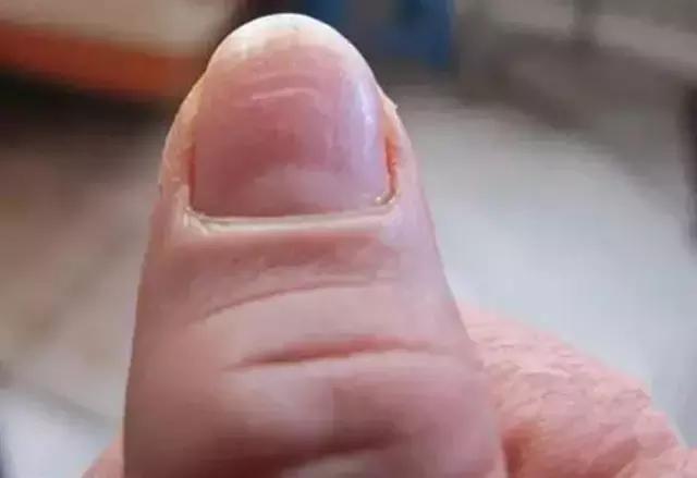 指甲上的月牙预示着什么,指甲上的月牙真的和健康有关系吗