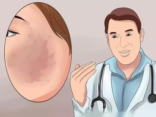 消除脸上黑点的最有效方法,产后脸上黑点怎么消除