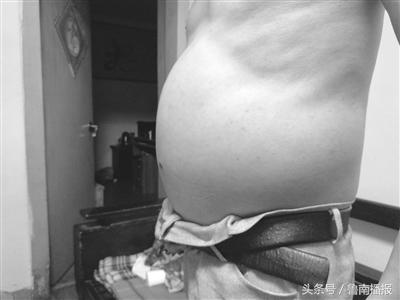 孩子得了怪病只剩最后一根解药了,儿子得怪病母亲四处奔波为其治病