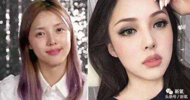 杨紫微整前后容颜对比,杨紫瘦了吗